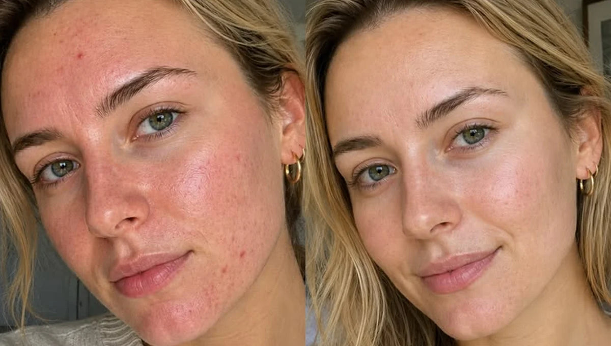 Before and after results