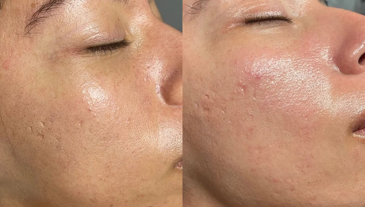 Before and after results